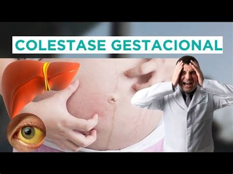 colestase gestacional-4